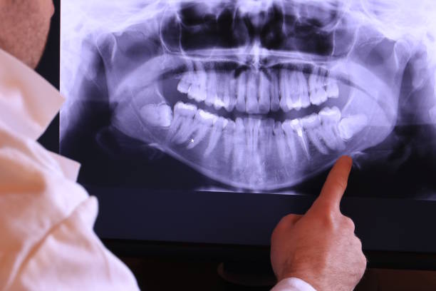 Best Emergency Treatment for Oral Infections in Village Of Waukesha, WI